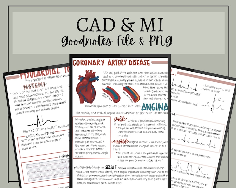 Coronary Artery Disease, Myocardial Infarction Nursing Notes // Digital ...