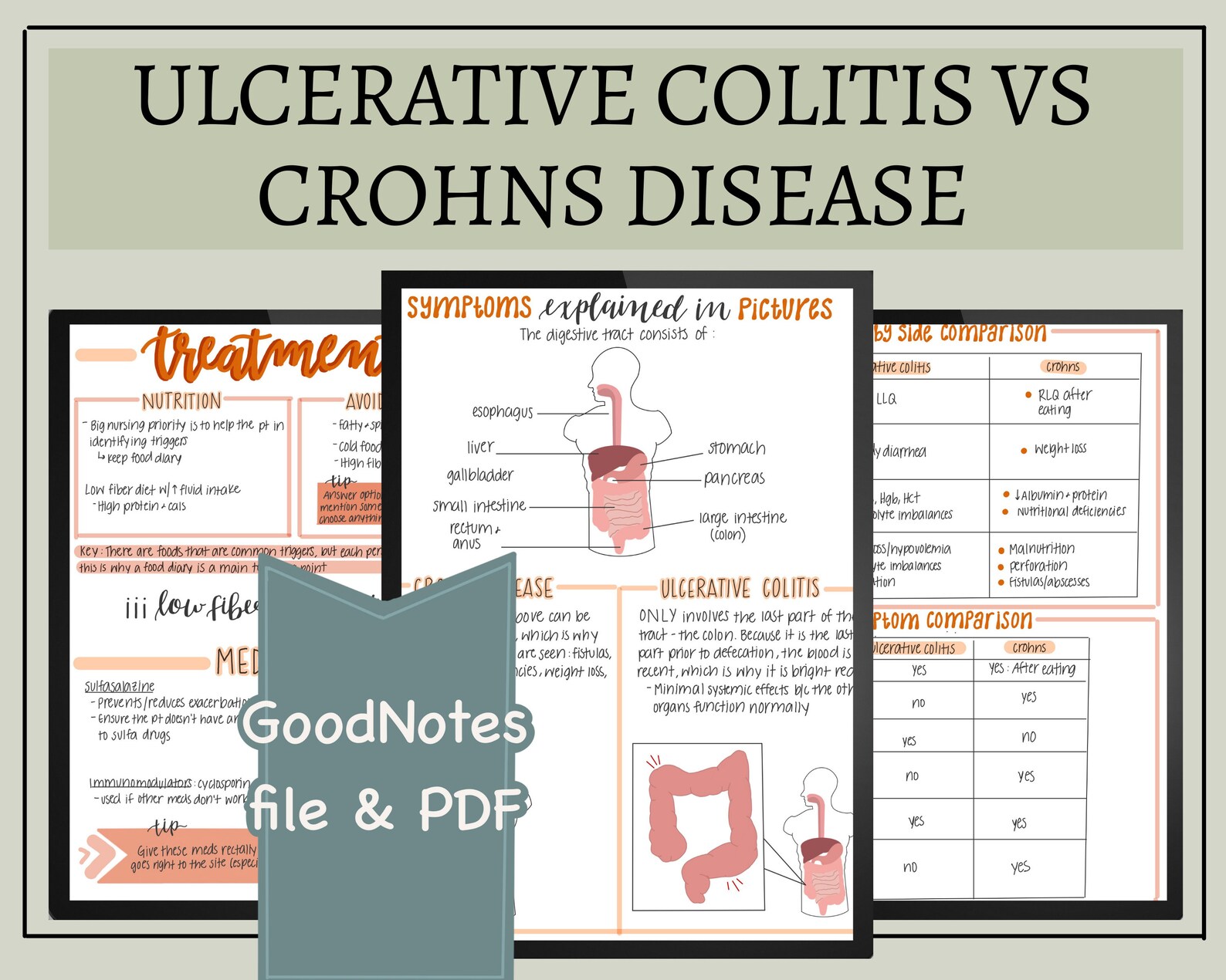 Ulcerative Colitis Vs Crohns Disease Nursing Notes // Digital Download