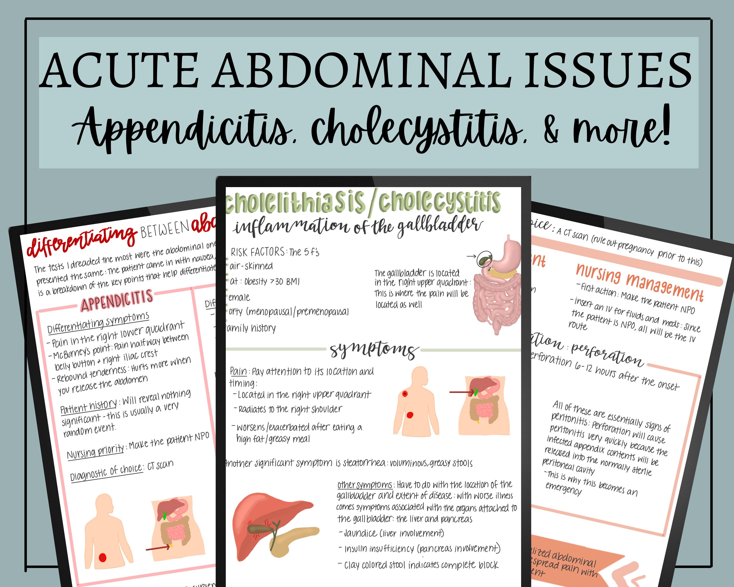 Acute Abdominal Issues Nursing Notes // Digital Download // Goodnotes ...