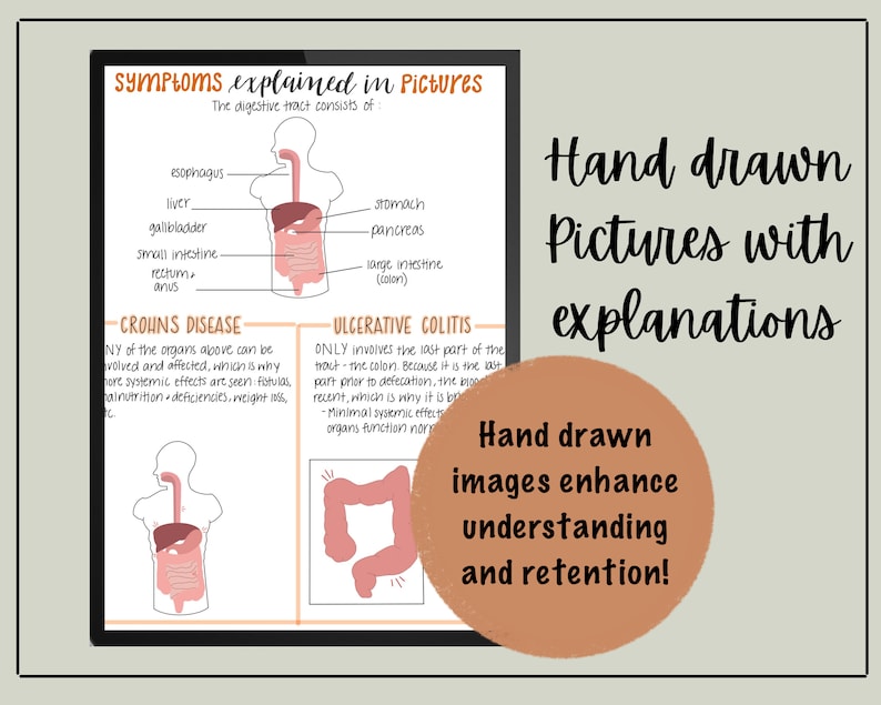 Ulcerative Colitis Vs Crohns Disease Nursing Notes // Digital Download ...
