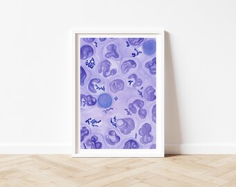 Art Print "Veterinary Cytology - Infectious Diseases": Septic neutrophilic inflammation