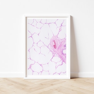 Histologie Aquarell Kunstdruck: Lunge, H&E-Färbung