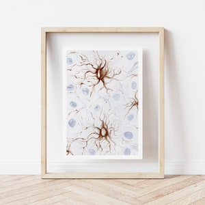 Neuropathology Series: Tufted Astrocytes – Watercolor Art Print