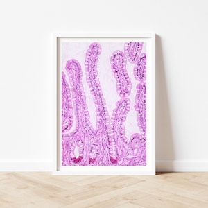 Histologie Aquarell Kunstdruck: Ileum, H&E-Färbung