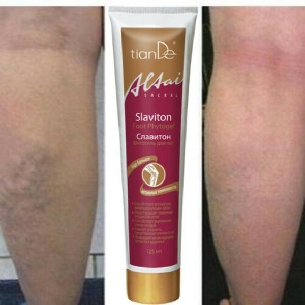 Krampfadern Beine Creme Sore Restless Massage Gel Slaviton TianDe 125 ml