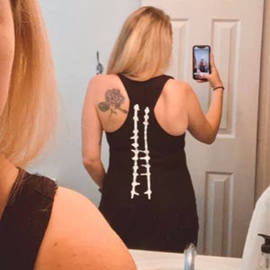 Scoliosis Tank top, T shirt, Hoodies