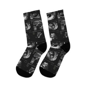 May include: A pair of black socks with a pattern of ultrasound images of a baby. The socks are made of a soft, comfortable material and are perfect for everyday wear.