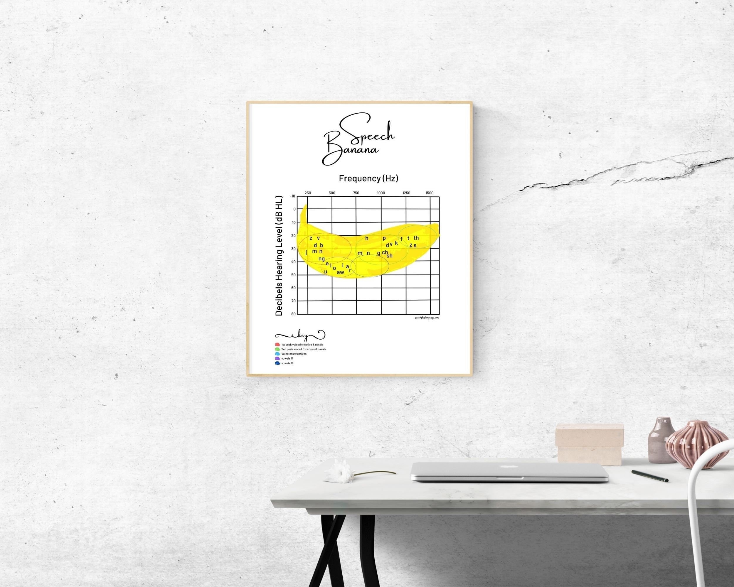 Asha Speech Banana Audiogram