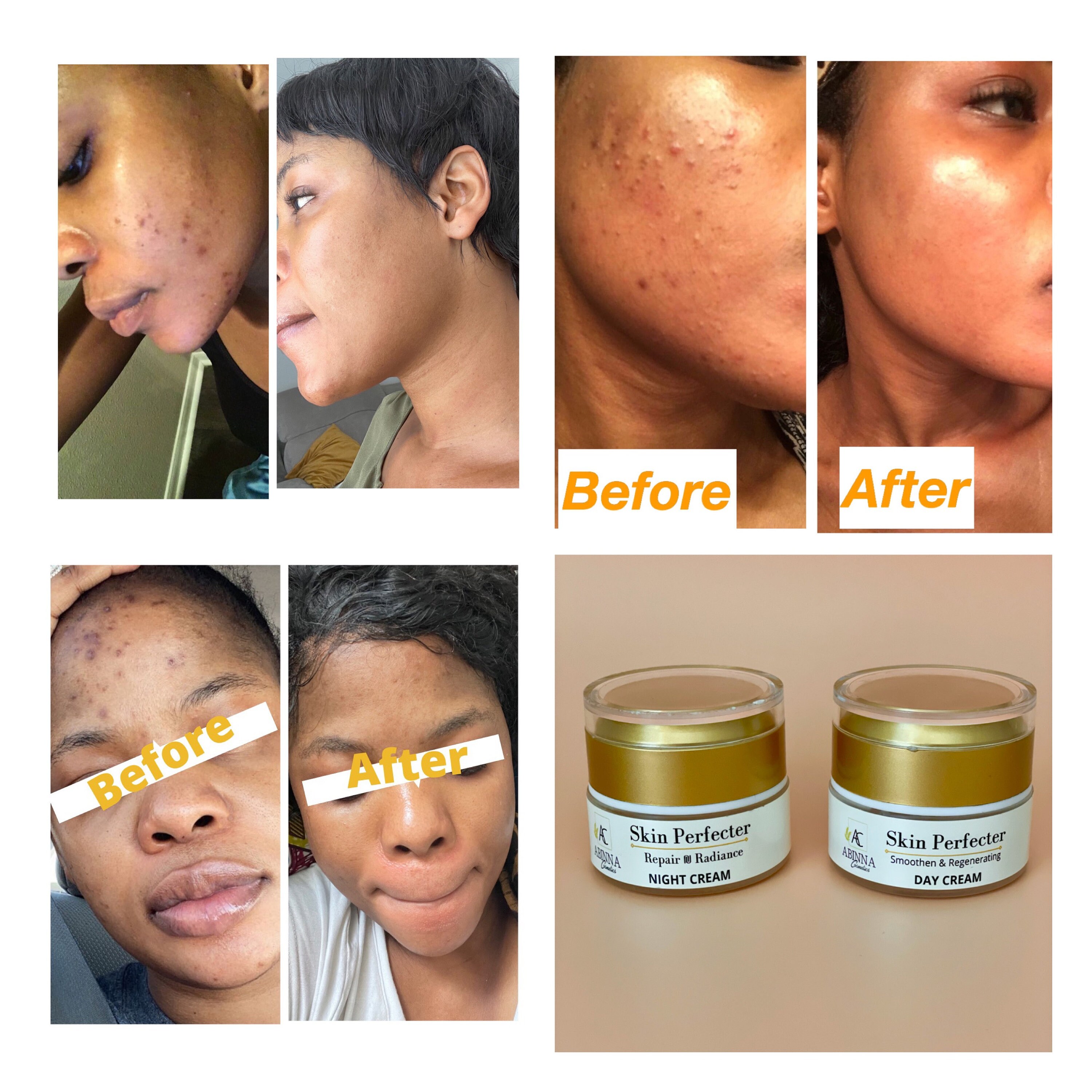 Dark Spot Skin Discoloration Treatment Effectively Treat Etsy New Zealand