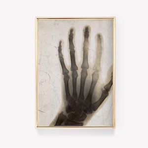 Könnte beinhalten: Ein Vintage-Schwarzweiß-Röntgenbild einer menschlichen Hand, gerahmt in einem goldenen Rahmen.