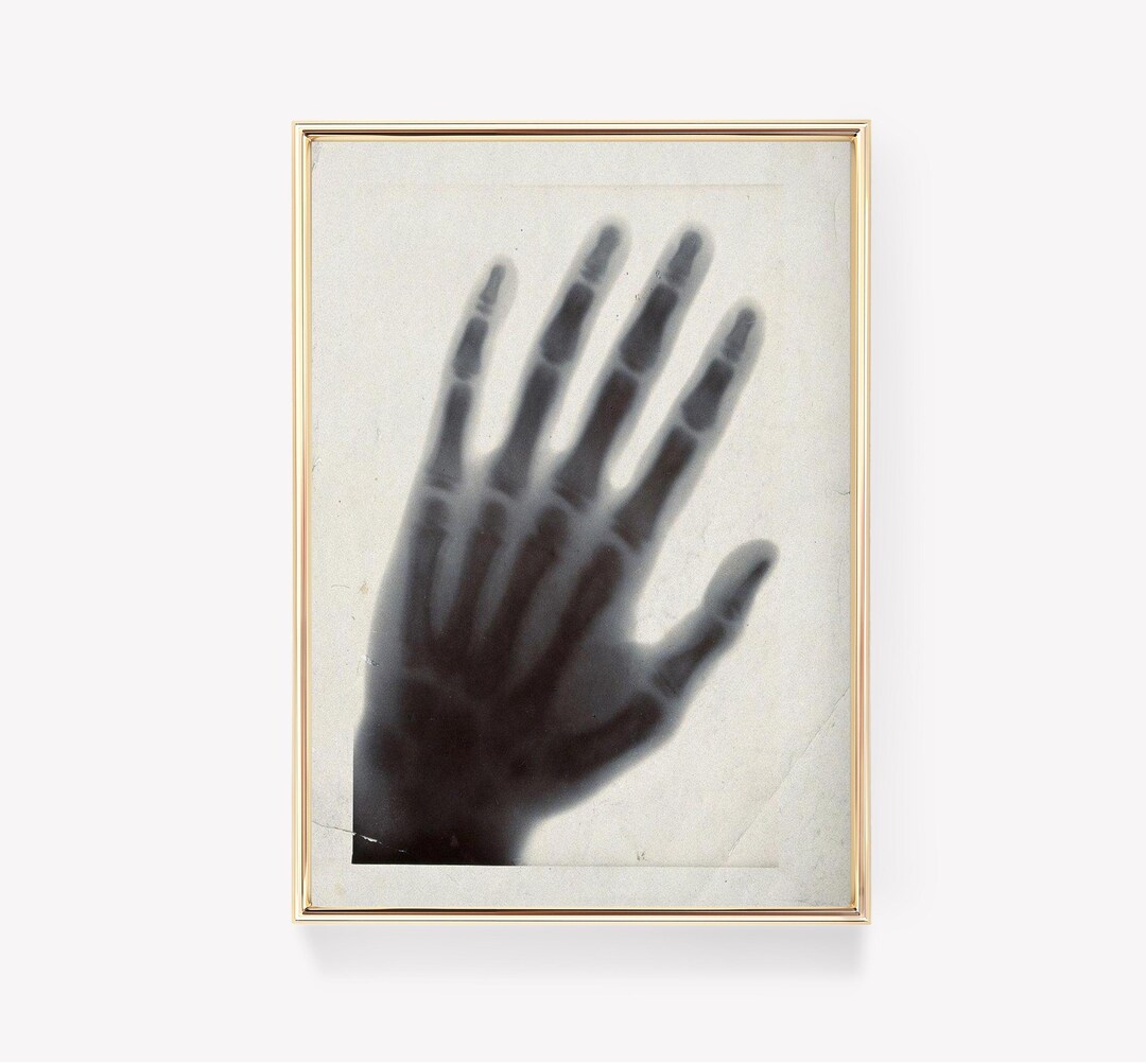 Wilhelm Röntgen | First X-ray Image | Pioneer Discovery | Historical X ...