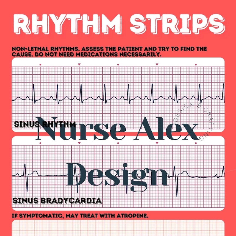 Heart Rythm Strip Samples Ekg Strip Sheets - Etsy