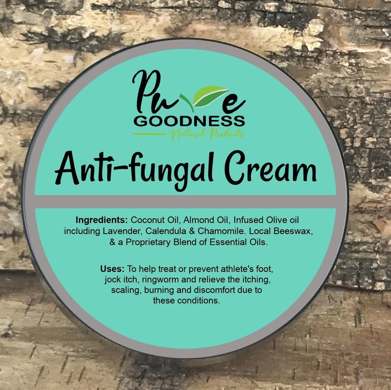 Antifungal Cream Tinea Versicolor Etsy UK