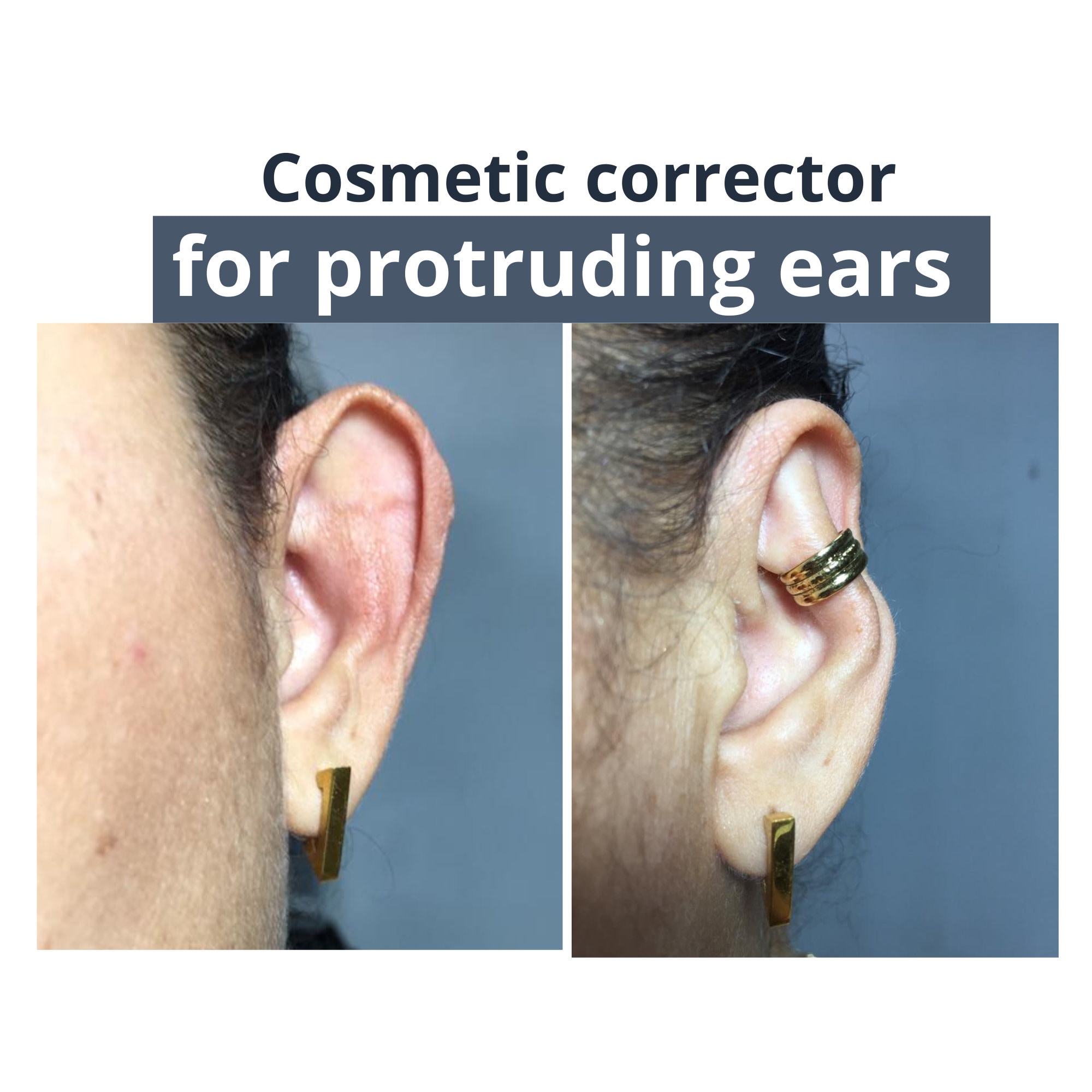 Correction d'oreille - Oreille - Autocollant - Oreille souple - Invisible -  Cosmétique