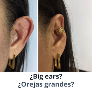 Pegatinas For Orejas Beauty Ear Corrector Lug Solutions Gen