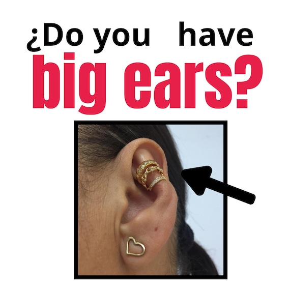 Ear cuff for protruding ears discount