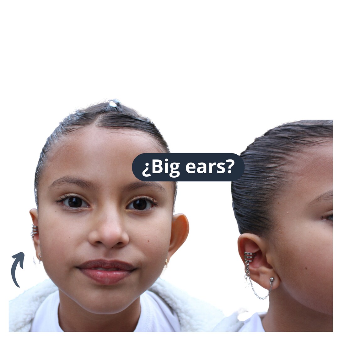 Big Ear Corrector aesthetic Ear Corrector Etsy