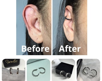 Earcuff for prominent ears