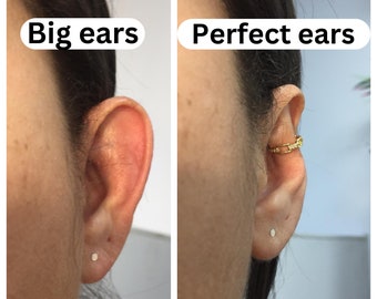 Earcuff for protruding ears