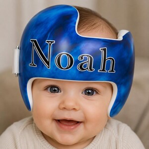 Könnte beinhalten: Ein kranialer Remodellierungshelm mit einem leuchtend blauen Marmormuster und dem Namen Noah in einer fetten weißen Serifenschrift auf der Vorderseite. Der Helm hat ein weißes Innenfutter und einen weißen Seitenriemen mit einer Metallschnalle.