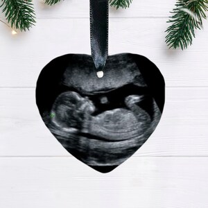 baby ultraschall bild keramik herz-personalisiert weihnachtsbaumschmuck