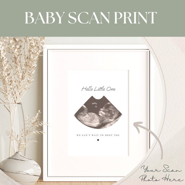 Ultrasound Gifts 60+ Gift Ideas for 2024