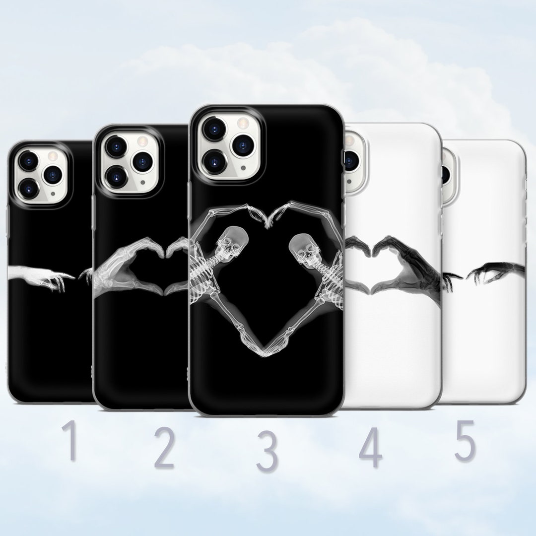 Xray Phone Case, Aesthetic Skeleton, Black and White Xray Cover Fits