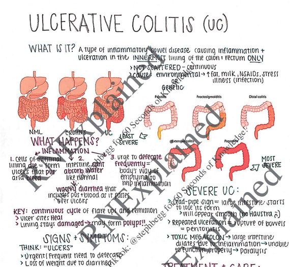 Ulcerative Colitis nursing Study Sheets Etsy Ireland