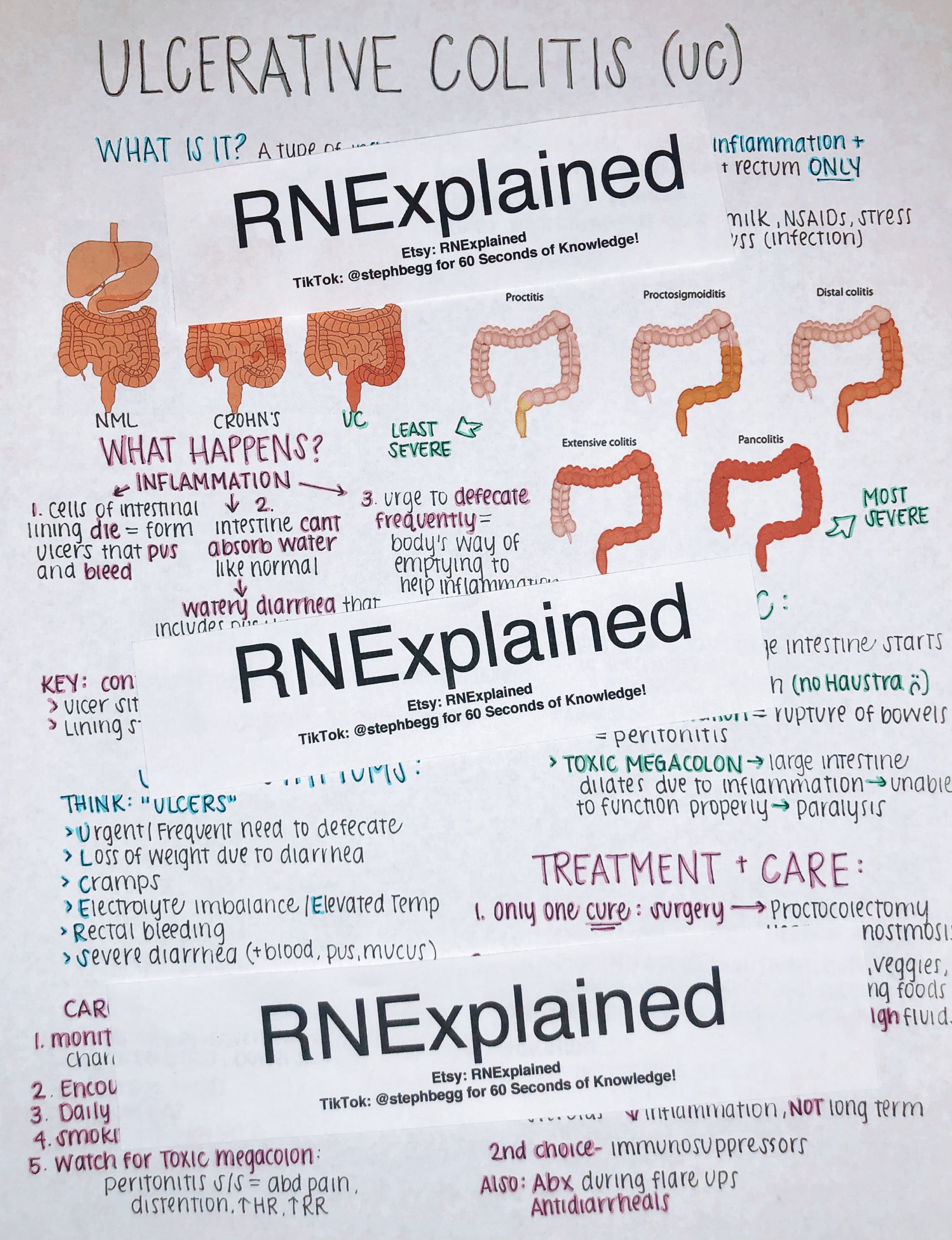 ulcerative colitis nursing case study