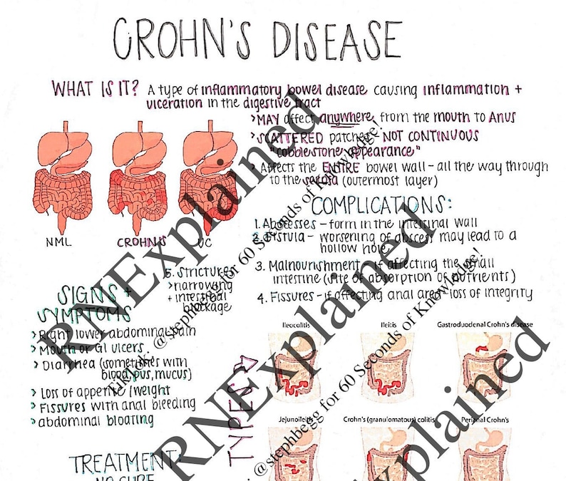 Crohns Disease nursing Study Sheets Etsy