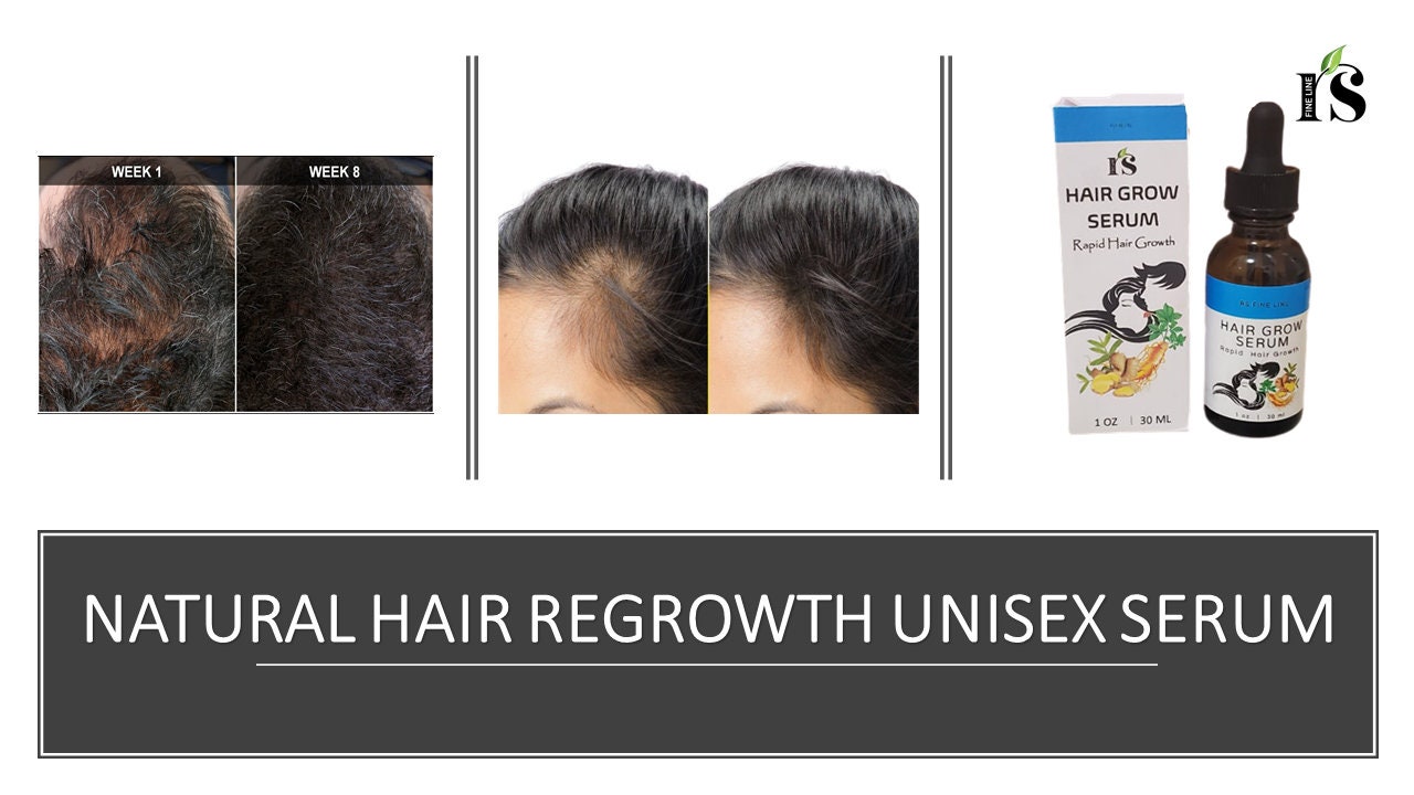 Hair Grow Serum Essential Oil trabaja para estimular y Etsy