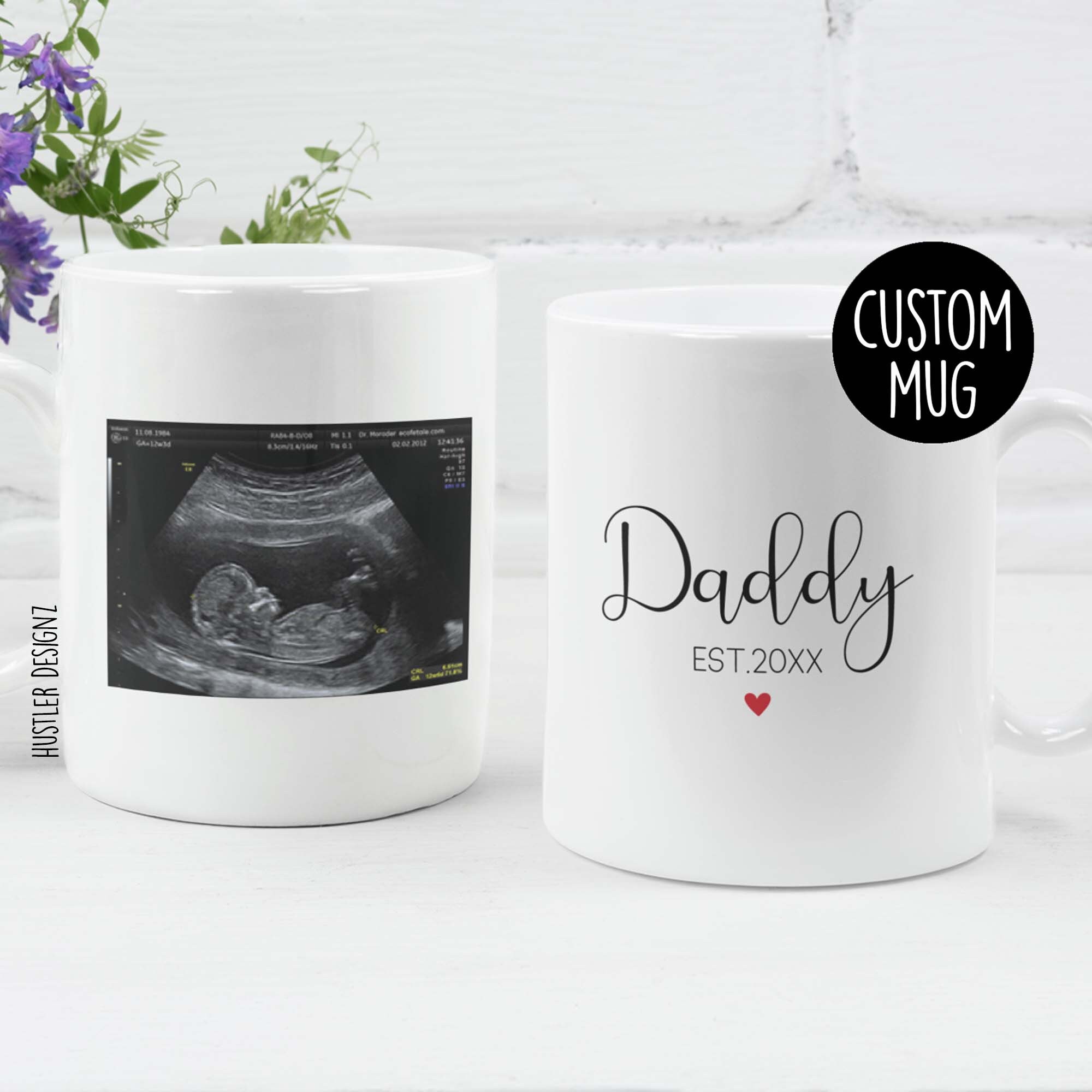 Mom And Dad To Be Gifts Personalzed Sonogram Mug, Ultrasound Photo Gft Mug, Pregnancy Reveal Mom And Dad Gifts