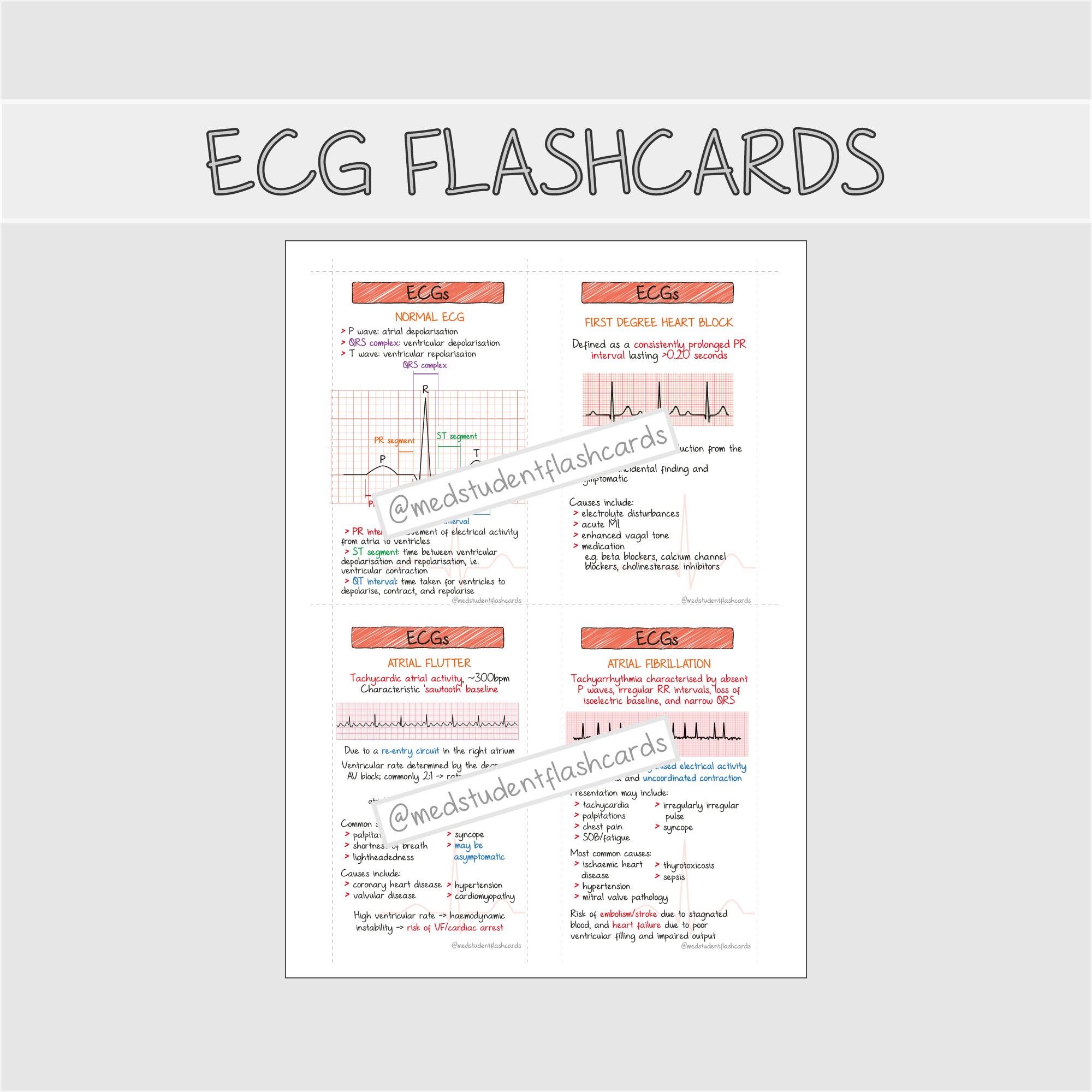 ECG Rhythms Flashcards PDF - Etsy India