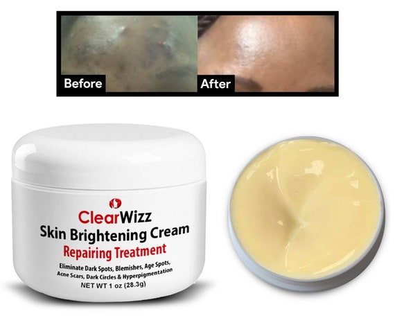 dark spots remover cream