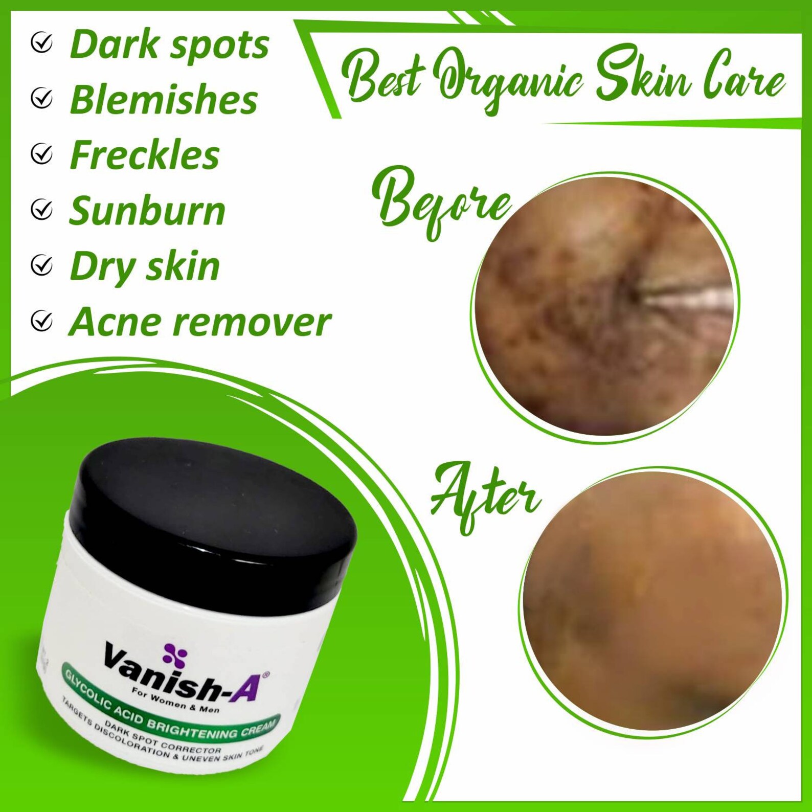 SCAR Remover Glycolic Acid Brightening Cream Effective Etsy