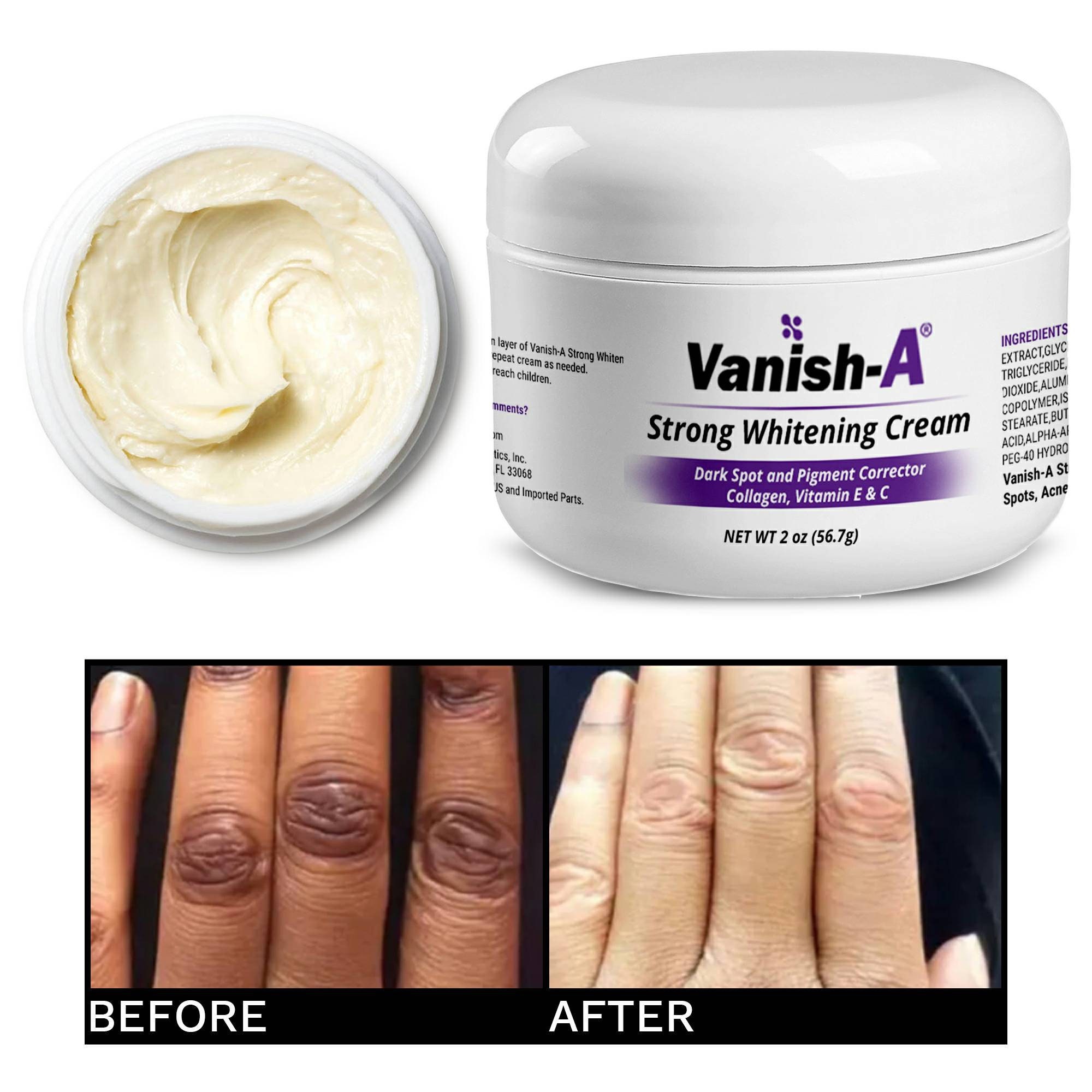 1 oz Dark Spot Corrector Whitening Ceam Knees & Elbow Etsy