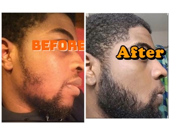 beard stimulation kit