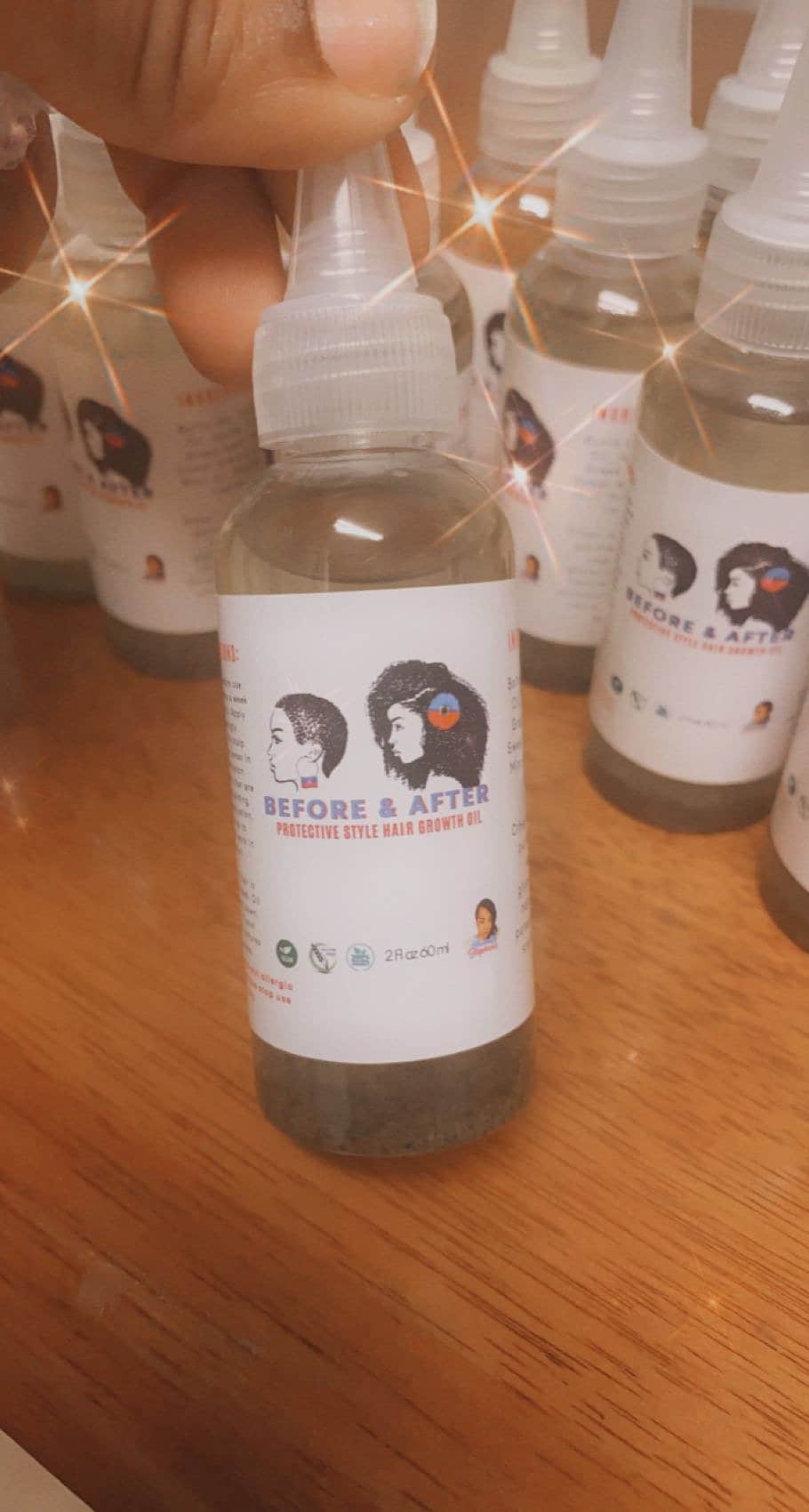 Fast Results Scalp Care & edges/hair growth Oil. Treats Dermatitis, Eczema and Alopecia. Vegan Friendly