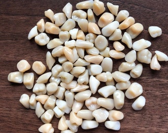 10+ CRACKED AND BROKEN Real Human Teeth - Molars, Premolars, & Anteriors