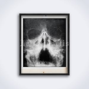 X-Ray Human skull face – anatomy, radiology photo, vintage medical art print, poster (DIGITAL DOWNLOAD)