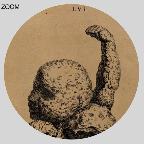 石の赤ちゃんの石版画：1733年の解剖学的奇異（デジタルダウンロード