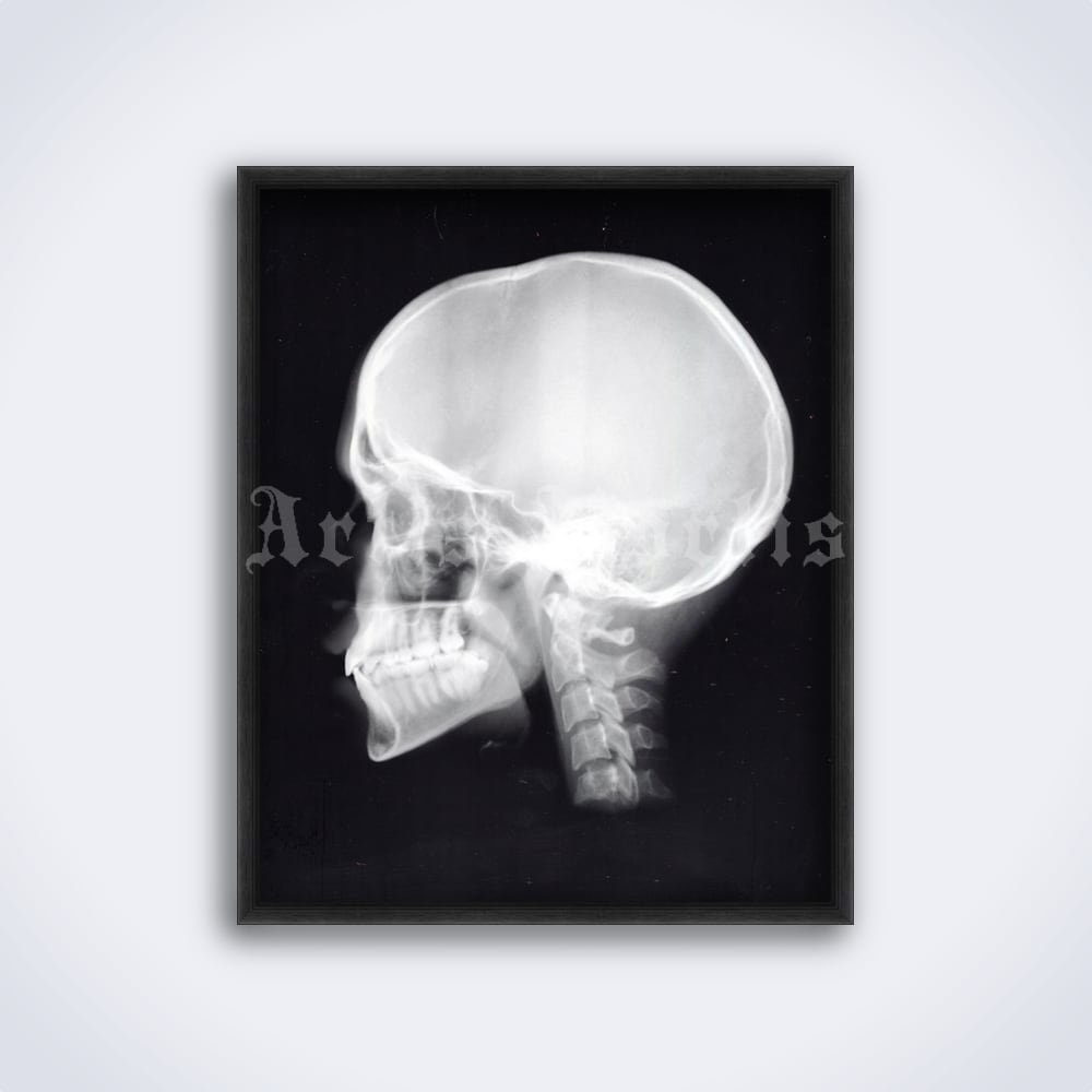 Xray Human Skull Lateral View Anatomy Radiology Photo Etsy