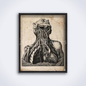 Chemotherapie, menschliche Körperdissektion, Anatomie – vintage Medizinischer Kunstdruck, Poster (DIGITAL DOWNLOAD)