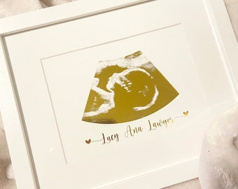 Gold Foil Sonogram and Ultrasound, Mother&#39;s Day Gift, Baby Ultrasound Art, Sonogram Print, Gender Reveal, Sonography Art, Pregnancy Gift