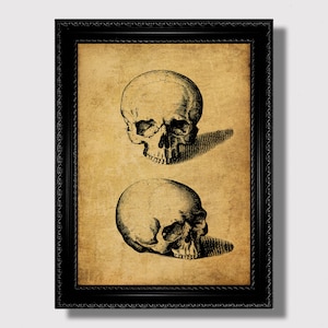 Anatomical Skull Print – Twin Craniums, Victorian Medical Art, Macabre Science Illustration, Curiosity Room Wall Hanging