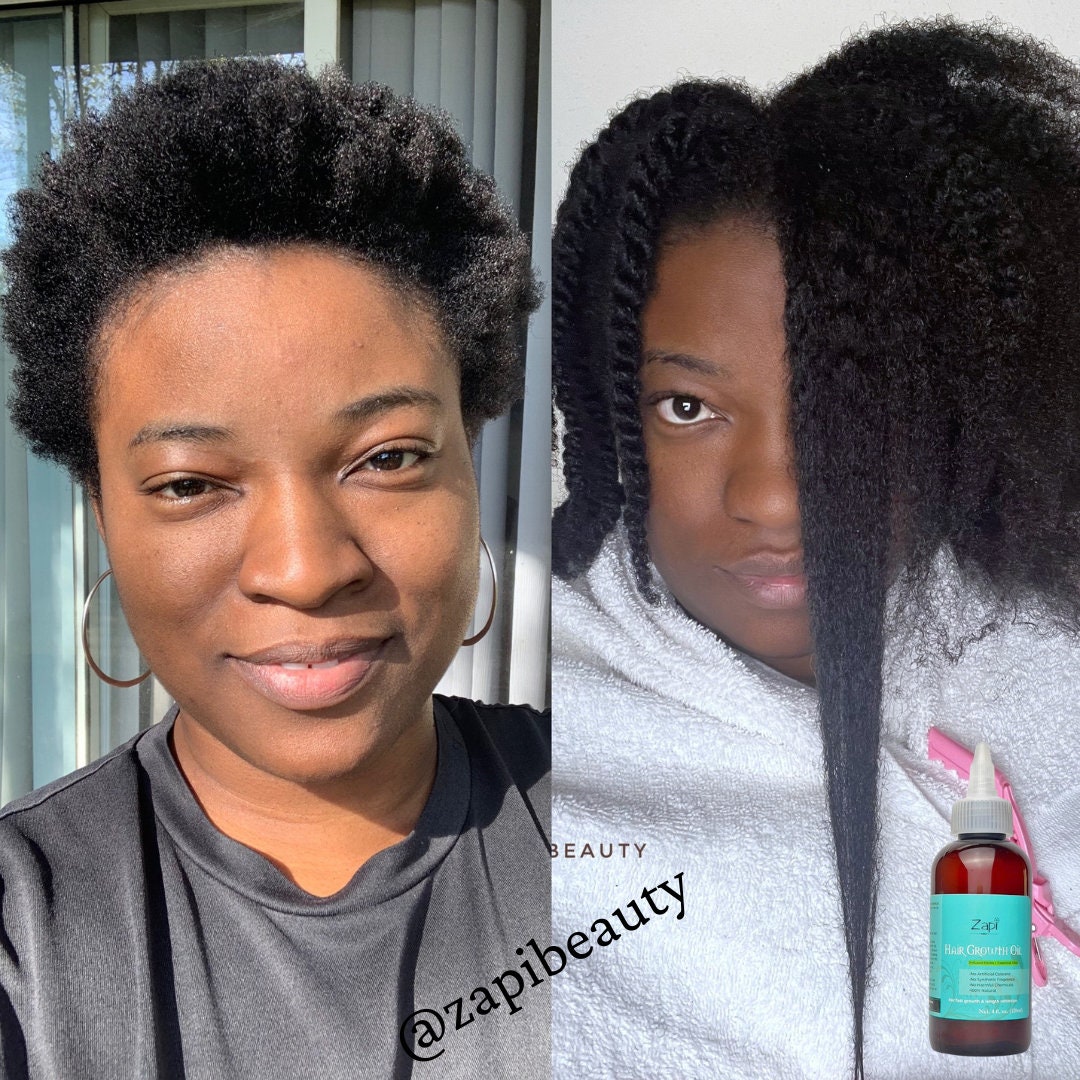 Hair Growth Products for Black Women - Etsy Hair Growth Products for Black Women - Etsy