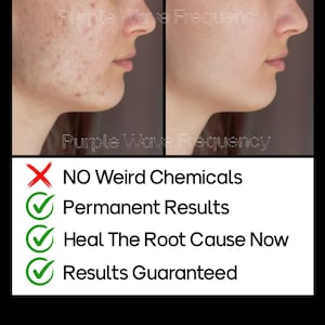 May include: Before and after photos of a person's face showing the results of a skin care treatment. The text on the image reads: 'NO Weird Chemicals', 'Permanent Results', 'Heal The Root Cause Now', 'Results Guaranteed'.