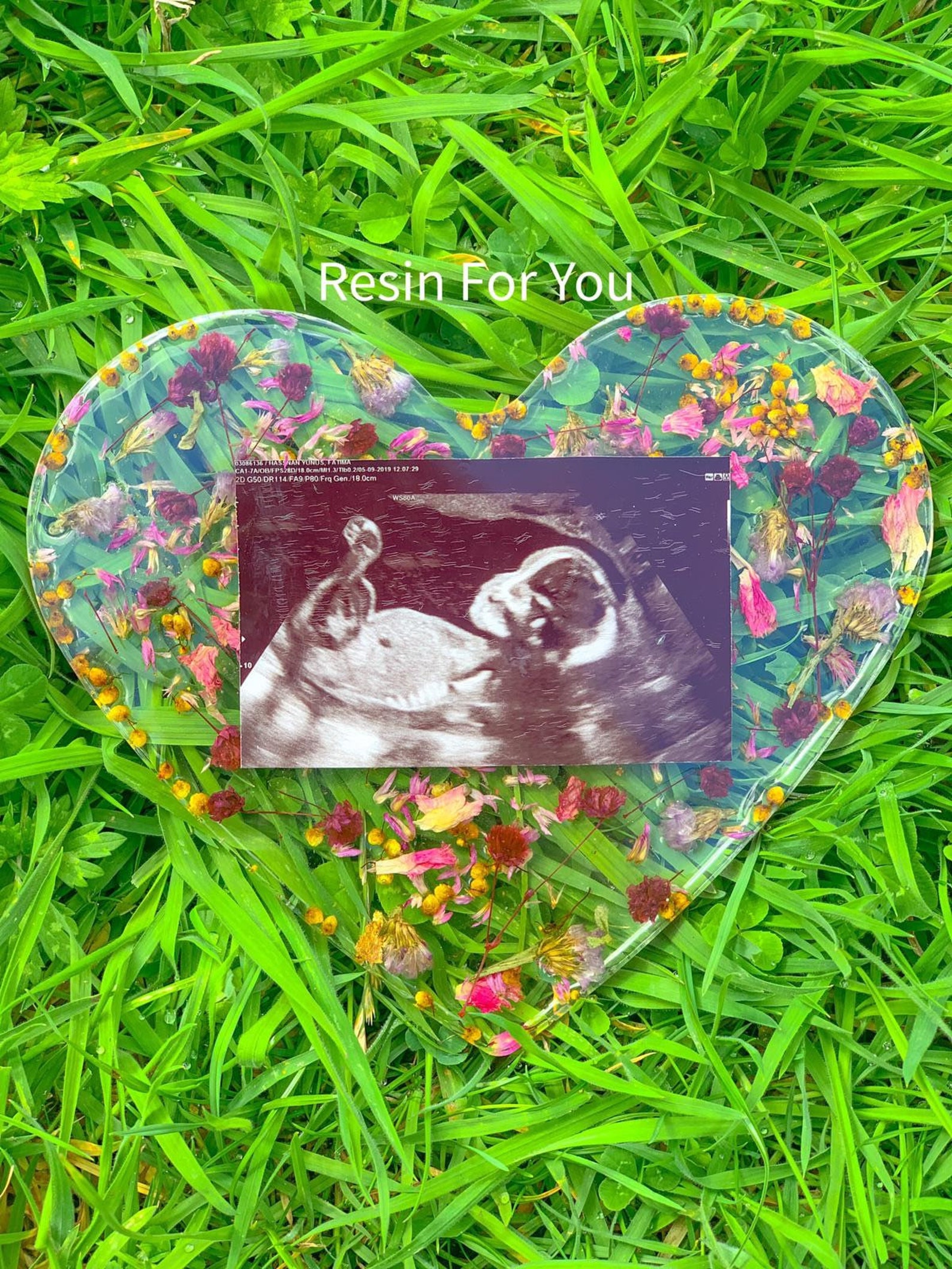 Baby Ultrasound Resin Keepsake Personal Gift Etsy UK