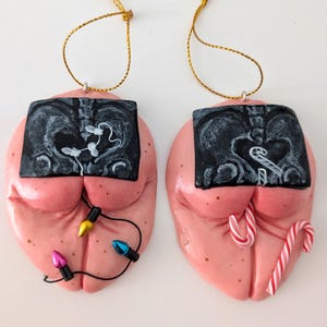 May include: Two pink, heart-shaped ornaments with a textured surface. Each features a black rectangular X-ray image of a pelvis. One ornament is decorated with a string of colorful miniature light bulbs, while the other has two red and white candy canes.