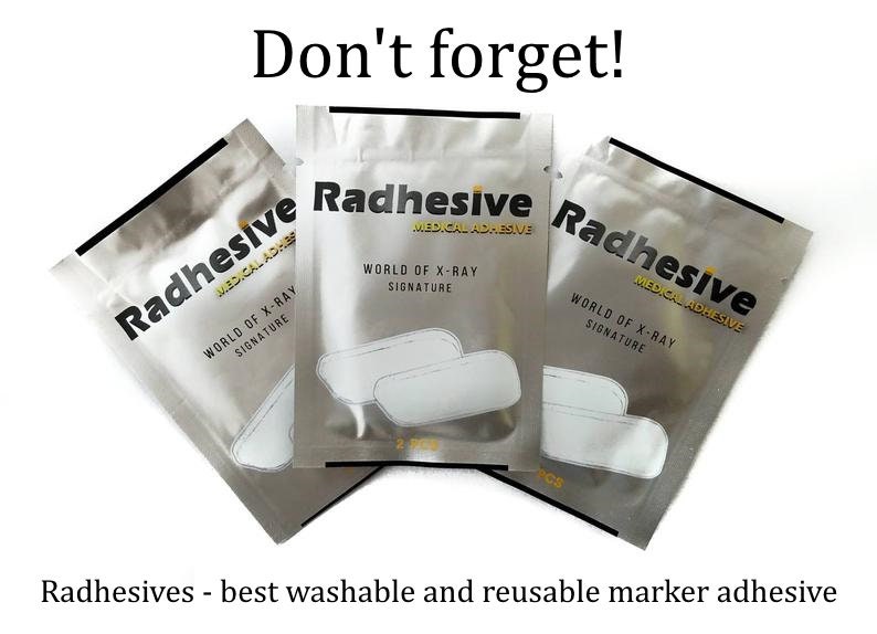 PA Hand Xray Markers - Rad Tech Gift - Anatomy Xray Markers